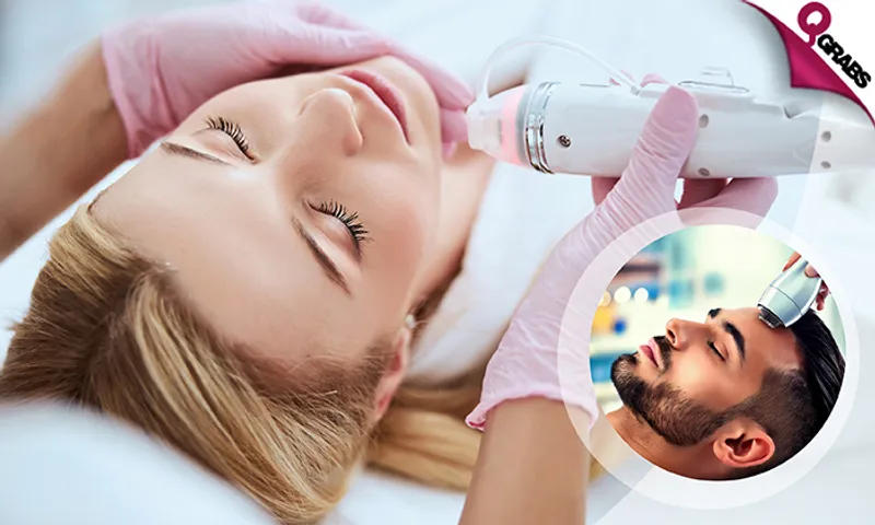 Radio Frequency Microneedling Skin Treatment for Ladies & Men!